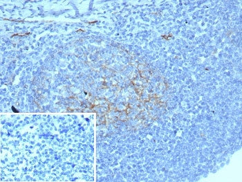 IHC staining of FFPE human tonsil tissue with recombinant CD54 antibody (clone ICAM1/8677R). Inset: