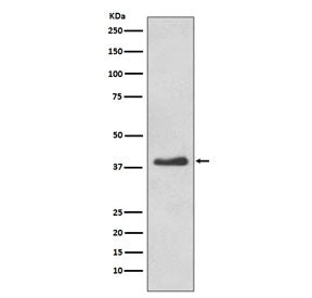 DKK1 Antibody