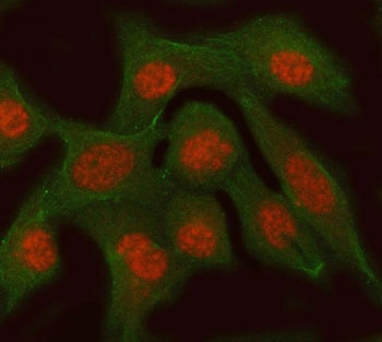 RFC3 Antibody / Replication factor C subunit 3