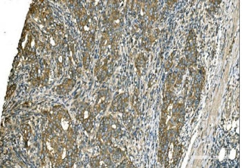 GOT1 Antibody / Glutamic-oxaloacetic transaminase 1