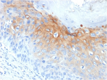 Cytokeratin 1 Antibody