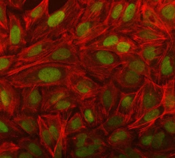 NOSIP Antibody / Nitric oxide synthase-interacting protein