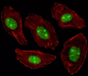 Nucleophosmin Antibody (Npm1)