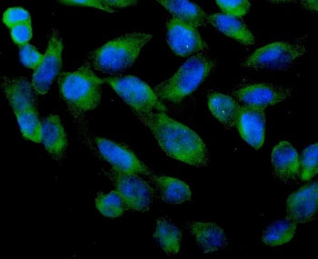 ARA9 Antibody
