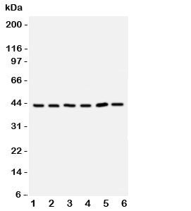 Western blot testing of TRAM antbody; Lane 1: rat brain; 2: (r) kidney; 3: human 293T; 4: (h) Raji;
