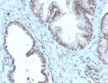 IHC staining of FFPE human prostate tissue with Prostein antibody (clone SLC45A3/4965R). HIER: boil