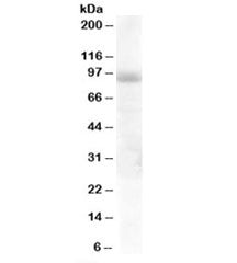 Western blot testing of human lung lysate with HPS6 antibody at 1ug/ml. Predicted molecular weight: