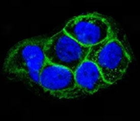 EGF Receptor / EGFR Antibody