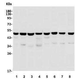 Western blot testing of rat 1) brain, 2) testis, 3) liver, 4) spleen and mouse 5) brain, 6) testis,
