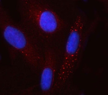 GCM1 Antibody / Glial cells missing homolog 1 / GCMA