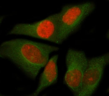 NOC4L Antibody / Nucleolar complex-associated protein 4-like