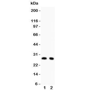 Western blot testing of p27KIP1 antibody and Lane 1: rat thymus; 2: rat brain lysate. Expected/obser