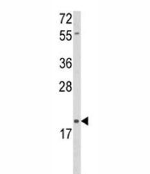 Western blot analysis of DLK2 antibody and HL-60 lysate. Predicted molecular weight: 40/21 kDa (isof