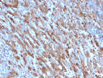 C1QA Antibody / Complement C1q A-Chain