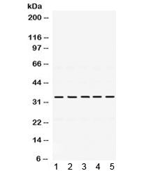 TIMP3 Antibody