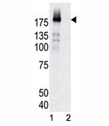EGF Receptor Antibody (phospho-Y998)