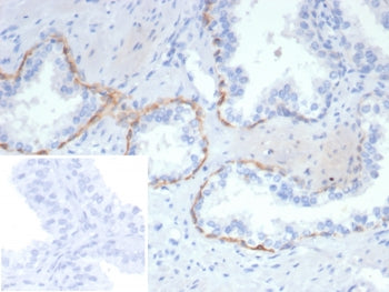 IHC staining of FFPE human prostate tissue with CK14 antibody (clone rKRT14/7269). Inset: PBS used i