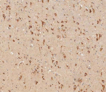 IFNAR1 Antibody / Interferon alpha receptor 1