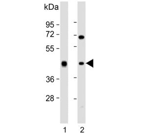 Alcohol dehydrogenase Antibody / ADH1B