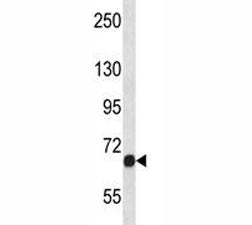 Fgfr1 antibody western blot analysis in NCI-H460 lysate. Predicted molecular weight: 75-160 kDa depe
