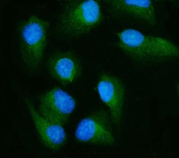 RALBP1 Antibody / RLIP1