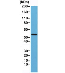 Desmin Antibody