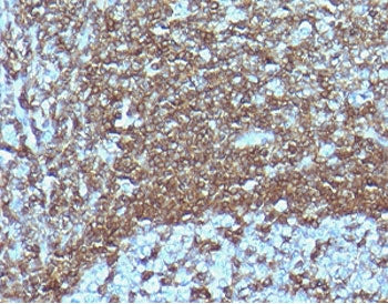 IHC staining of FFPE human tonsil tissue with recombinant CD6 antibody (clone CDLA6-2R). HIER: boil