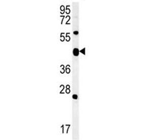 ACSF3 Antibody