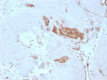 IHC staining of FFPE human tonsil with SPTAN1 antibody. HIER: boil tissue sections in pH 9 10mM Tris