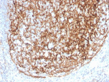 IHC staining of FFPE human tonsil with recombinant CD35 antibody (clone CR1/4382R). HIER: boil tissu