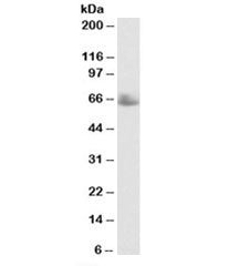 Western blot testing of human testis lysate with TERF1 antibody at 0.3ug/ml. Predicted molecular wei