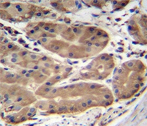 ABHD2 antibody immunohistochemistry analysis in formalin fixed and paraffin embedded human stomach tissue.