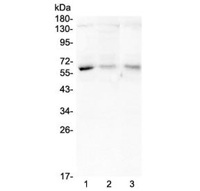 ARSA Antibody
