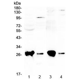 GSTT1 Antibody / Glutathione S Transferase theta 1