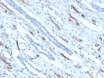 Adiponectin Antibody