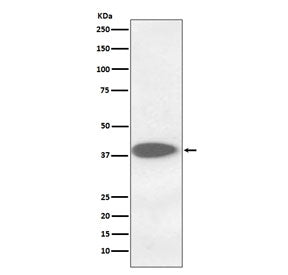 Cathepsin B Antibody / CTSB