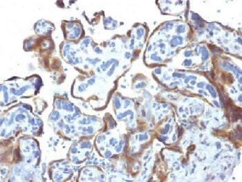 TIMP2 Antibody