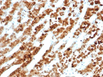 IL18RAP Antibody / CD218b
