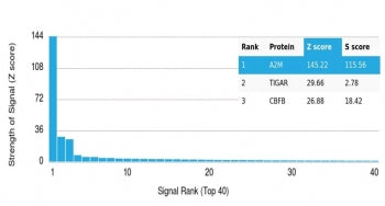 Analysis of HuProt(TM) microarray containing more than 19,000 full-length human proteins using Alpha