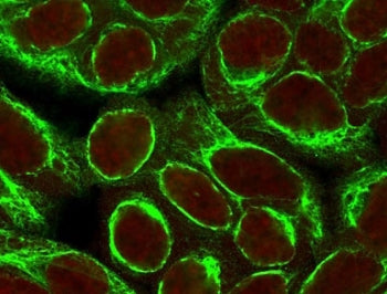 KRT8 Antibody / Cytokeratin 8