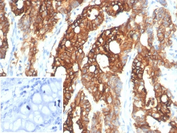 S100A14 Antibody