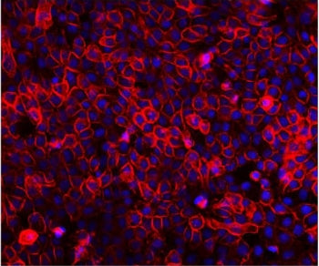 EGF Receptor / EGFR Antibody