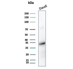 Western blot testing of human Daudi cell lysate with YY1 antibody (YY1/5436). Predicted molecular we