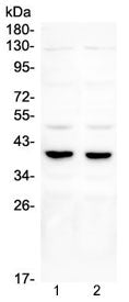 Western blot testing of 1) rat testis and 2) mouse testis lysate with DMRT1 antibody. Expected/obser