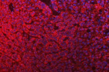 SLC25A10 Antibody / Mitochondrial Dicarboxylate Carrier