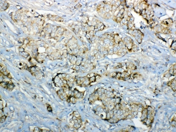 GALNS Antibody