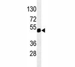 PAX6 Antibody