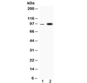 Western blot testing of 1) rat skeletal muscle and 2) human HepG2 cell lysate with Fibrinogen alpha