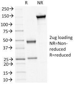 Desmoglein 3 Antibody / DSG3