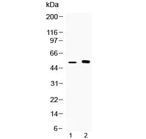 CDR2 Antibody